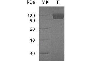 Western Blotting (WB) image for TYRO3 Protein Tyrosine Kinase (TYRO3) protein (Fc Tag) (ABIN7320679) (TYRO3 Protein (Fc Tag))