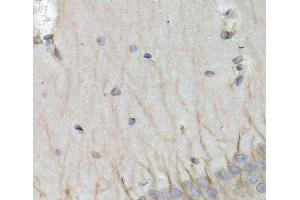 Immunohistochemistry (Paraffin-embedded Sections) (IHC (p)) image for anti-Proteasome (Prosome, Macropain) Subunit, beta Type 10 (PSMB10) antibody (ABIN7261409)