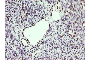 Image no. 2 for anti-ERG, ETS transcription factor (ERG) antibody (ABIN1498075) (ERG 抗体)