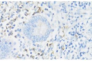 Immunohistochemistry of paraffin-embedded Human appendix using CD11A Polyclonal Antibody at dilution of 1:100 (40x lens). (ITGAL 抗体)