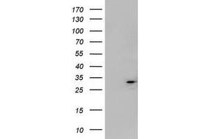 Image no. 1 for anti-Mitochondrial Translational Initiation Factor 3 (MTIF3) (AA 56-278) antibody (ABIN1491594) (MTIF3 抗体  (AA 56-278))
