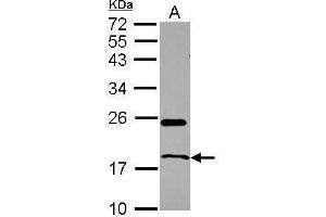 WB Image Sample (30 ug of whole cell lysate) A: U87-MG 12% SDS PAGE antibody diluted at 1:1000