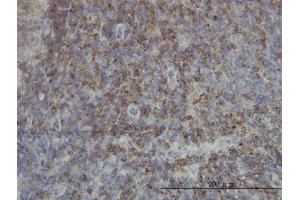Image no. 1 for anti-SH2 Domain Containing 3C (SH2D3C) (AA 1-111) antibody (ABIN599111) (SH2D3C 抗体  (AA 1-111))