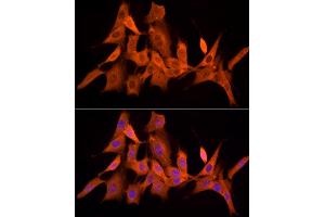 Immunofluorescence analysis of NIH/3T3 cells using PSMC5 Rabbit mAb (ABIN7269585) at dilution of 1:50 (40x lens). (PSMC5 抗体)