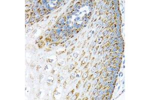 Immunohistochemistry of paraffin-embedded human esophagus using LRPPRC antibody.