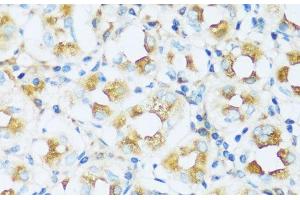 Immunohistochemistry of paraffin-embedded Human stomach using APOD Polyclonal Antibody at dilution of 1:100 (40x lens). (Apolipoprotein D 抗体)