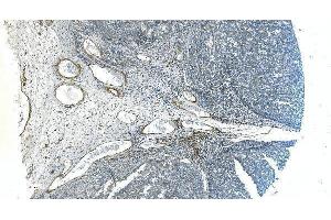 IHC analysis of H Cadherin/CDH13 using anti-H Cadherin/CDH13 antibody (ABIN7600095). (Cadherin 13 抗体  (AA 149-692))