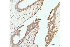 IHC analysis of Golgin 97/GOLGA1 using anti-Golgin 97/GOLGA1 antibody (ABIN7599539).