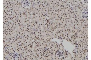 ABIN6264346 and ABIN6276931 at 1/100 staining Rat kidney tissue by IHC-P.