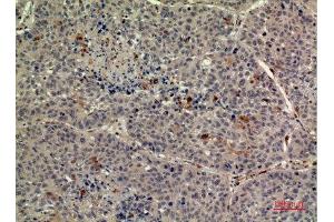 Immunohistochemistry (IHC) image for anti-Thrombopoietin (THPO) (Internal Region) antibody (ABIN6283933)