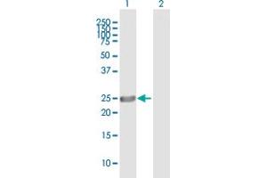 Western Blot analysis of ASPH expression in transfected 293T cell line by ASPH MaxPab polyclonal antibody. (Aspartate beta Hydroxylase 抗体  (AA 1-210))