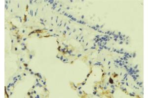 ABIN6273906 at 1/100 staining Mouse lung tissue by IHC-P. (GPR183 抗体  (Internal Region))