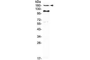Western blot testing of human MCF7 cell lysate with VEGFR2 antibody at 0. (VEGFR2/CD309 抗体)