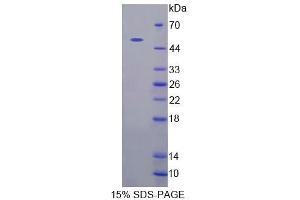 SDS-PAGE analysis of Human CADPS Protein. (CADPS 蛋白)