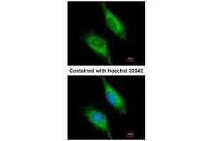 Immunofluorescence (IF) image for anti-Fas-Activated serine/threonine Kinase (FASTK) (C-Term) antibody (ABIN2855426)