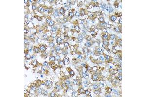 Immunohistochemistry of paraffin-embedded rat liver using Cytochrome P450 4A (CYP4) (CYP4) Rabbit mAb (ABIN7266658) at dilution of 1:100 (40x lens). (CYP4A11 抗体)