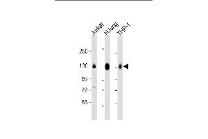 All lanes : Anti-CD31 Antibody (C-term) at 1:2000 dilution Lane 1: Jurkat whole cell lysate Lane 2: human lung lysate Lane 3: THP-1 whole cell lysate Lysates/proteins at 20 μg per lane.