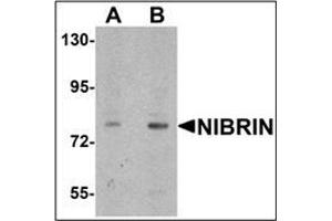 Western blot analysis of NIBRIN in rat lung tissue lysate with NIBRIN antibody (N-term) Cat. (Nibrin 抗体  (N-Term))