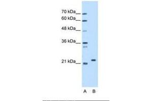 Image no. 1 for anti-Stromal Cell Derived Factor 2 (SDF2) (AA 31-80) antibody (ABIN321503) (SDF2 抗体  (AA 31-80))