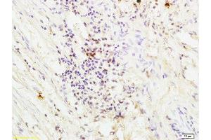 Immunohistochemistry (Paraffin-embedded Sections) (IHC (p)) image for anti-Coagulation Factor II (thrombin) Receptor (F2R) (AA 251-350) antibody (ABIN728743)