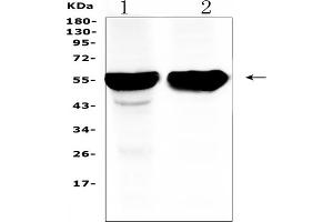 Western blot analysis of Cytochrome P450 2D6 using anti-Cytochrome P450 2D6 antibody (ABIN5518823).