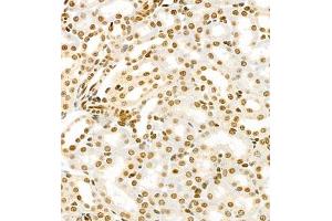 Immunohistochemistry of paraffin embedded mouse kidney using HIF-3α (ABIN7074273) at dilution of 1:1600 (400x lens) (HIF3A 抗体)