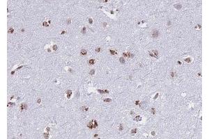ABIN6268739 at 1/100 staining human brain tissue sections by IHC-P. (Cathepsin D 抗体  (C-Term))