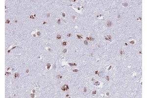 ABIN6268739 at 1/100 staining human brain tissue sections by IHC-P.