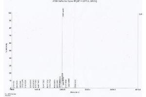 Image no. 1 for Pro-Brain Natriuretic Peptide (NT-ProBNP) (NT-ProBNP) (N-Term) peptide (Ovalbumin) (ABIN5666287) (Pro-Brain Natriuretic Peptide (NT-ProBNP) (NT-ProBNP) (N-Term) peptide (Ovalbumin))