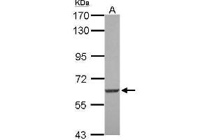 WB Image Sample (30 ug of whole cell lysate) A: U87-MG 7. (SGK3 抗体  (N-Term))