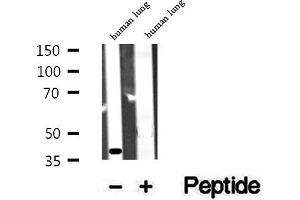 Western blot analysis of extracts of human lung tissue, using ACAA1 antibody. (ACAA1 抗体  (N-Term))