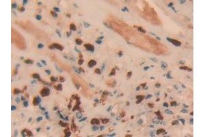 Immunohistochemistry (IHC) image for anti-Ubiquitin Carboxyl-terminal Esterase L1 (Ubiquitin Thiolesterase) (UCHL1) (AA 2-223) antibody (ABIN7436390)