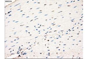 Immunohistochemical staining of paraffin-embedded prostate tissue using anti-MAP2K1 mouse monoclonal antibody. (MEK1 抗体)