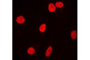 Immunofluorescent analysis of Ku80 staining in HeLa cells. (XRCC5 抗体  (C-Term))