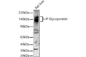 Western blot analysis of extracts of Rat liver, using P Glycoprotein antibody (ABIN7265732) at 1:500 dilution.