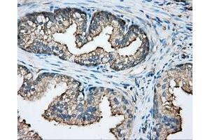 Immunohistochemical staining of paraffin-embedded pancreas tissue using anti-CAPZA1 mouse monoclonal antibody. (CAPZA1 抗体)