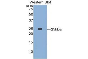 Detection of Recombinant SMC3, Human using Polyclonal Antibody to Structural Maintenance Of Chromosomes Protein 3 (SMC3) (SMC3 抗体  (AA 994-1181))