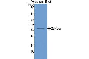 Western Blotting (WB) image for anti-Fast Skeletal Troponin I (TNNI2) (AA 1-182) antibody (ABIN1078623) (TNNI2 抗体  (AA 1-182))