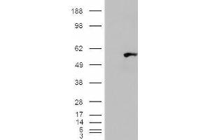 Western Blotting (WB) image for anti-WAS/WASL Interacting Protein Family, Member 1 (WIPF1) antibody (ABIN5906335) (WIPF1 抗体)