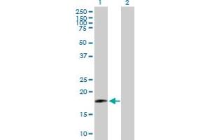 Western Blot analysis of SIVA1 expression in transfected 293T cell line by SIVA1 MaxPab polyclonal antibody. (SIVA1 抗体  (AA 1-175))