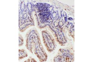 IHC analysis of IL-18 using anti- IL-18 antibody . (IL-18 抗体  (AA 36-192))