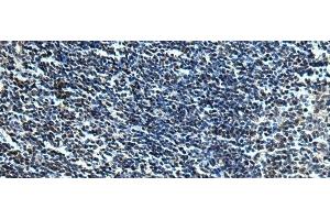Immunohistochemistry of paraffin-embedded Human tonsil tissue using SLC2A12 Polyclonal Antibody at dilution of 1:30(x200) (GLUT12 抗体)