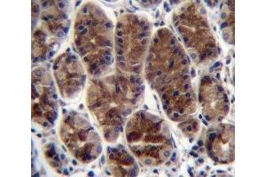 CTGF antibody immunohistochemistry analysis in formalin fixed and paraffin embedded human stomach tissue. (CTGF 抗体  (AA 134-159))