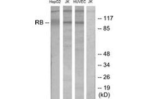 Western blot analysis of extracts from HepG2/Jurkat/HuvEc cells, using Retinoblastoma (Ab-780) Antibody. (Retinoblastoma Protein (Rb) 抗体  (AA 751-800))