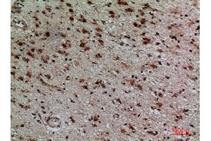 Immunohistochemistry (IHC) image for anti-Killer Cell Immunoglobulin-Like Receptor, three Domains, Long Cytoplasmic Tail, 3 (KIR3DL3) (Internal Region) antibody (ABIN6282363)
