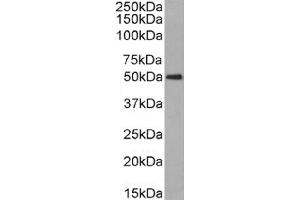 Western Blot using anti-CD63 antibody NK-1-C3. (Recombinant CD63 抗体)