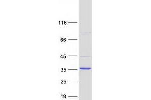 Western Blotting (WB) image for Catechol-O-Methyltransferase Domain Containing 1 (COMTD1) protein (Myc-DYKDDDDK Tag) (ABIN2712476)