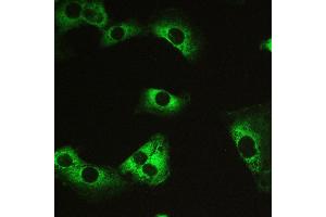 Immunohistochemistry (IHC) image for anti-Myosin Phosphatase, Target Subunit 1 (PPP1R12A) (AA 1-40), (N-Term) antibody (ABIN3043902)