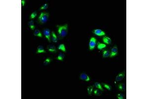 Immunofluorescence staining of Hela cells with ABIN7162326 at 1:100, counter-stained with DAPI. (Otogelin (OTOG) (AA 1634-1796) 抗体)