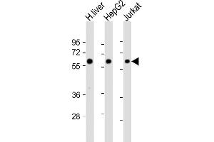All lanes : Anti-CYP2E1 Antibody (Center) at 1:4000 dilution Lane 1: human liver lysate Lane 2: HepG2 whole cell lysate Lane 3: Jurkat whole cell lysate Lysates/proteins at 20 μg per lane. (CYP2E1 抗体  (AA 166-198))